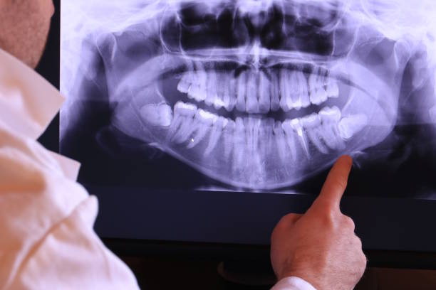 Best Emergency Treatment for Jaw Pain or Injury in Ojus, FL